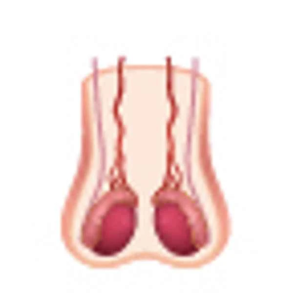 What causes scrotum to enlarge?