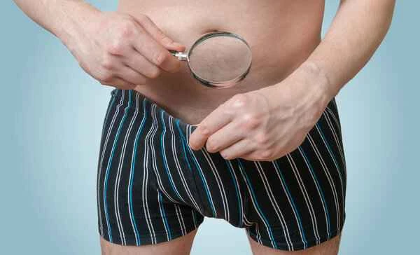 What's the best medication for scrotal dermatitis?