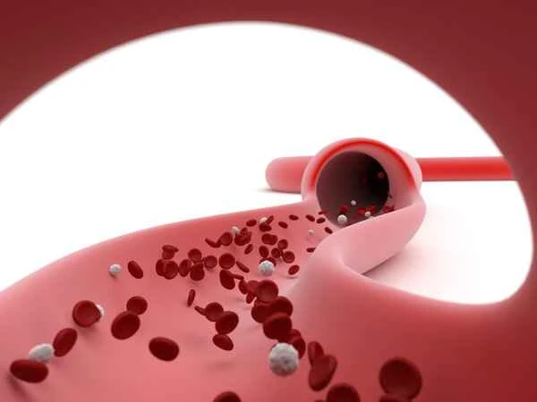 What surgery is needed if there are problems with scrotal ultrasound (CDFI)?