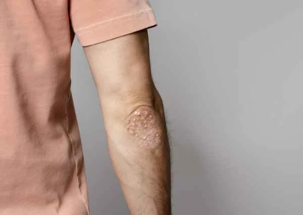 What causes scrotal pain in men?