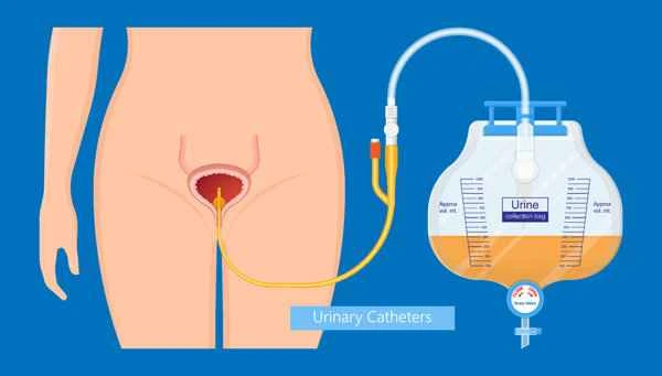 What are the causes of prostatitis?