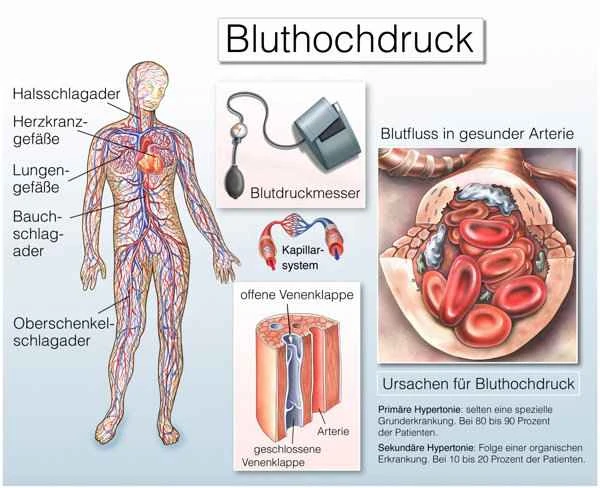 Jumping rope can improve sperm motility.