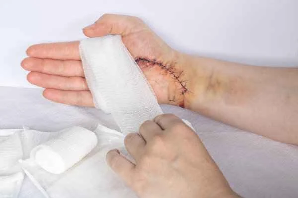 What causes scrotal redness and swelling?