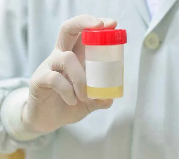 Blood clots in urine after prostatitis surgery