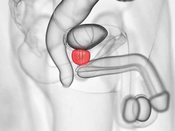 What medicine should I use for scrotal dampness and strong odor?