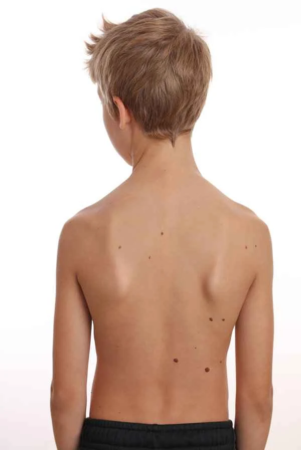 Can a boy's scrotum be asymmetrical?