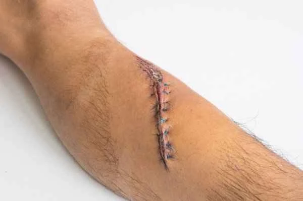 What causes pain when rubbing the scrotum and testicles?