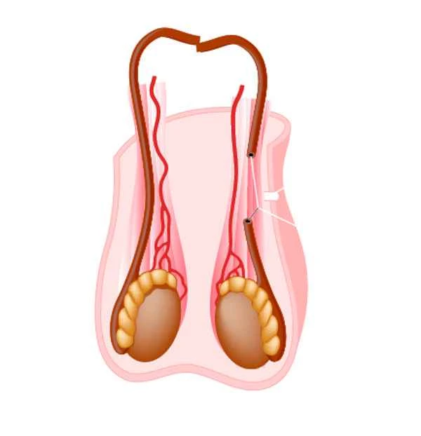 What causes an unusual odor in the scrotum?