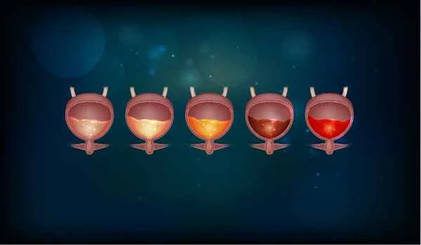 Does prostatitis cause frequent urination every day?